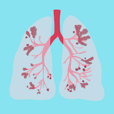COPD Basics