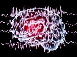 Ecstatic Epilepsy