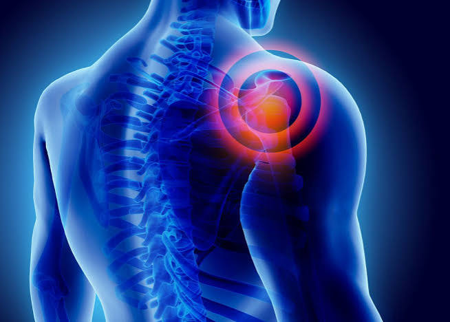 Supplements and Pain Management